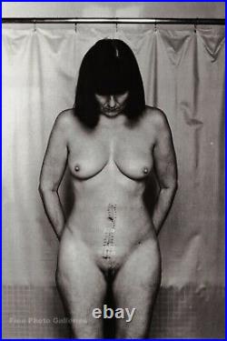 1982 Vintage Female Nude Stitches Scar By HELMUT NEWTON Wife Photo Art 11X14