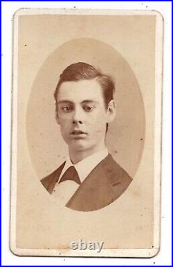ANTIQUE CDV CIRCA 1870s ROCKWOOD YOUNG CROSS-EYED MAN WITH AUTISM NEW YORK